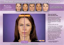 Juvederm Visualizer